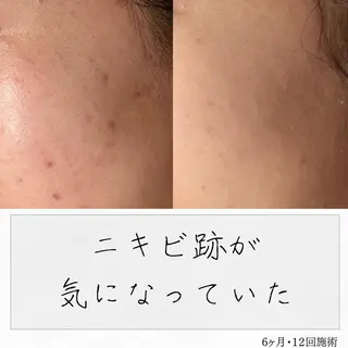ニキビ経験者が施術 する専門サロン🌻のエステ・リラクイメージ