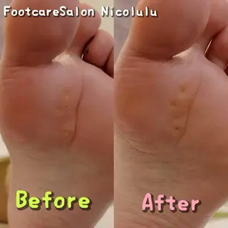 メンズ 足トラブル専門 ニコルル金沢のエステ・リラクイメージ