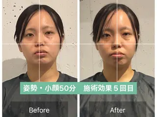 美容整体　小顔矯正 プラスフィール青田のエステ・リラクイメージ