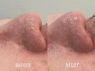 ニキビ・毛穴・肌荒れ &me 西宮北口店のその他イメージ