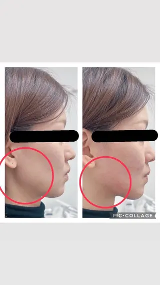 BeautySalonGemmy所属・Gemmy 愛美のエステ・リラクイメージ