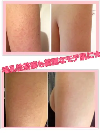 ハーブピーリング 専門店Kikkaのエステ・リラクイメージ