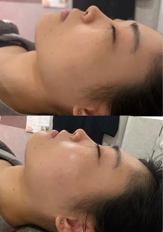 美容鍼灸サロン mahoroba院長のエステ・リラクイメージ