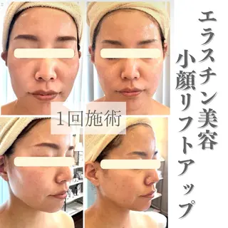 beauty SalonRcoinのマツエク・マツパデザイン