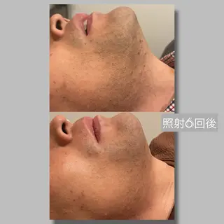 メンズ 小顔コルギ ☆表参道/外苑前のエステ・リラクイメージ
