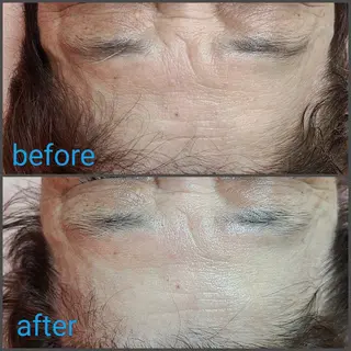 顔ツボ整顔セラピスト 三根百恵のエステ・リラクイメージ