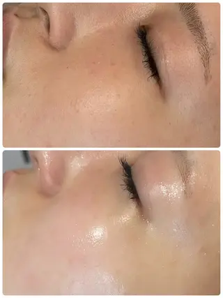 💎うる艶肌💎 スズキのエステ・リラクイメージ