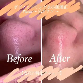 Plaran 〜プララン 〜のその他イメージ