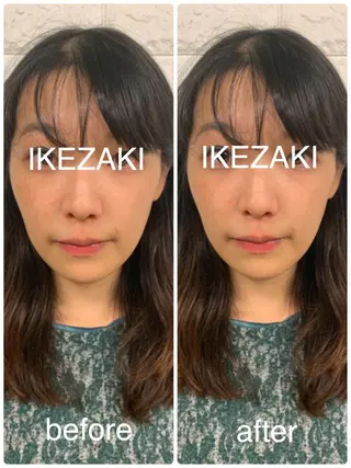 美容鍼 IKEZAKIのエステ・リラクイメージ