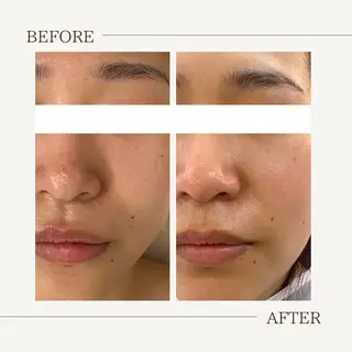 肌育成サロン ♡ RISAのエステ・リラクイメージ