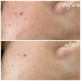 メンズ メナード岐阜茜部 杉浦のエステ・リラクイメージ