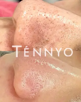 'OLI yukinaのエステ・リラクイメージ