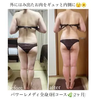 《本気痩せ×疲労改善 》  BILOOPのエステ・リラクイメージ