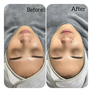 Éclat de Belle🫧白玉肌のその他イメージ