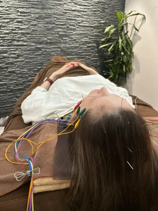 小顔矯/美容鍼/鍼灸 BeauJuのその他イメージ