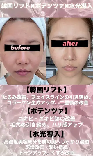 マツエク・マツパ 愛維美水光美肌専門店 メンズレディースokのエステ・リラクイメージ