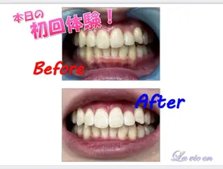 ホワイトニングサロン La vie enのその他イメージ