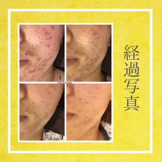 ミディアム カラー パーマ ヘアアレンジ メンズ キッズ ネイル マツエク・マツパ ニキビ・肌質改善専門 ♡人生が変わるサロンのエステ・リラクイメージ