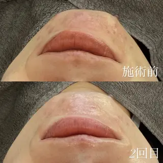 foi sayaのエステ・リラクイメージ