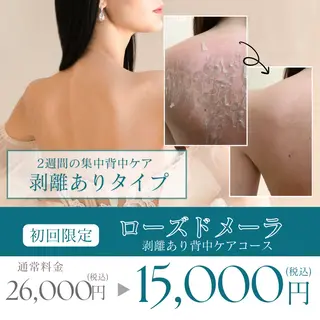 肌質改善ピーリング ✧BestBelleのエステ・リラクイメージ
