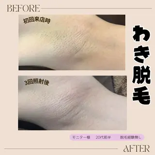 lieupré 脱毛 oshima‎⌣̈のエステ・リラクイメージ