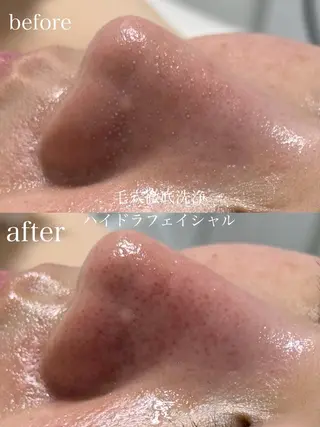 フェイシャルサロン CHIARA鈴木のエステ・リラクイメージ