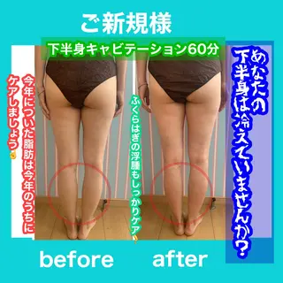 痩身/脱毛/ネイル HARUKAのエステ・リラクイメージ
