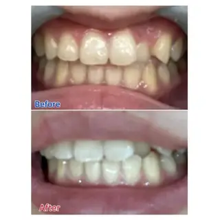 M渋谷 ホワイトニングのエステ・リラクイメージ