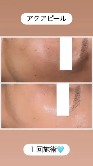 Raviy 【痩身・韓国肌管理】のエステ・リラクイメージ