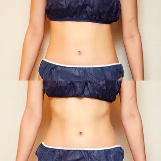 PLATINUM FEEL所属・菅尾 汐美のマツエク・マツパデザイン