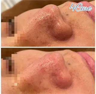 メンズ 4Care Yのネイルデザイン