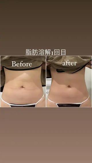 毛穴洗浄・痩身・脱毛 /アルカンジュのエステ・リラクイメージ