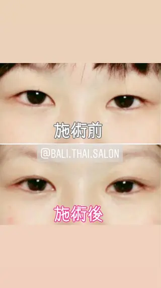 🌈歪み専門🌈 バリンタイ すぎうらのエステ・リラクイメージ
