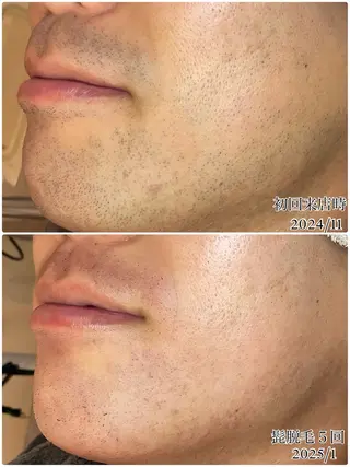 ＋belle／深澤 真緒🩵のエステ・リラクイメージ