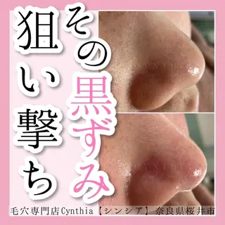 メンズ 毛穴ケア専門店 Cynthiaのエステ・リラクイメージ