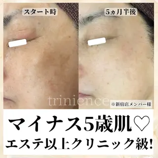 シミケア肌改善専門 トリニエンス新宿店のエステ・リラクイメージ