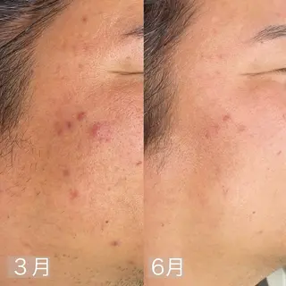 mone~total care salon~所属・mone (モーネ)のエステ・リラクイメージ