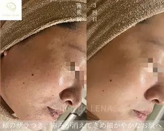 ハーブピーリング専門 グランディール　武内のエステ・リラクイメージ