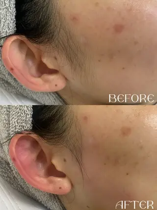 schön所属・schön 松井のエステ・リラクイメージ