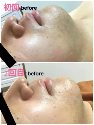 メンズ BELLEFINE 💕痩身・小顔・脱毛のエステ・リラクイメージ