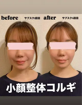 小顔コルギ/美容整体 /恵比寿/阿部迅のエステ・リラクイメージ