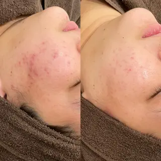 エステサロンTug高知駅前店所属・Tug 高知駅前店/ NANAMI🌐のエステ・リラクイメージ