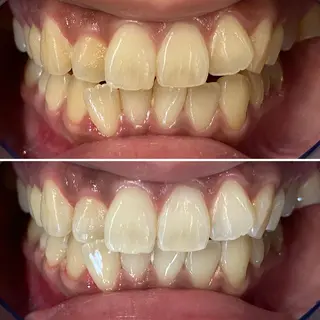 ホワイトニングサロン CREWのその他イメージ