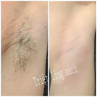 トウ フェンのエステ・リラクイメージ