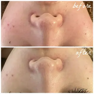 メンズ メナード岐阜市茜部 杉浦のエステ・リラクイメージ