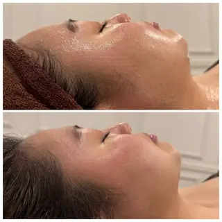 小顔EX心斎橋 REVIハーブのエステ・リラクイメージ