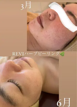 小顔&デコルテ Spa “koti”のエステ・リラクイメージ