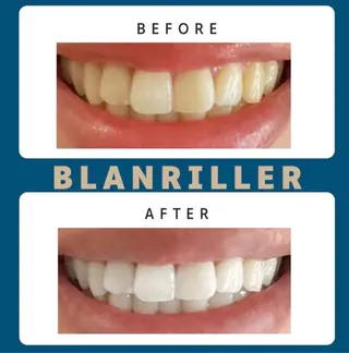 BLANRILLER所属・ホワイトニングサロン ブランリエ阿倍野店のその他イメージ