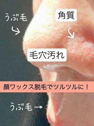 KIRAN 山﨑のエステ・リラクイメージ