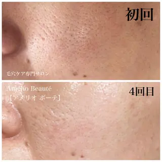 毛穴ケア専門サロン アメリオボーテのその他イメージ